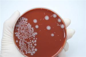 The Heat of Bacteria