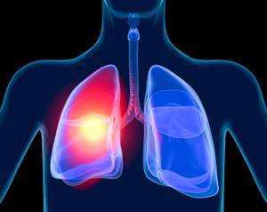 Examining Lung Capacity and Age