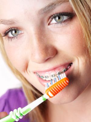 How Clean Are Your Dental Retainers?